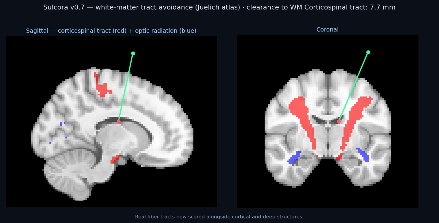 White-matter tract avoidance